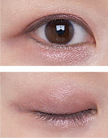 アイスカルプト アッシー ローズ