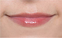 キヌケアグローアップ PK 343